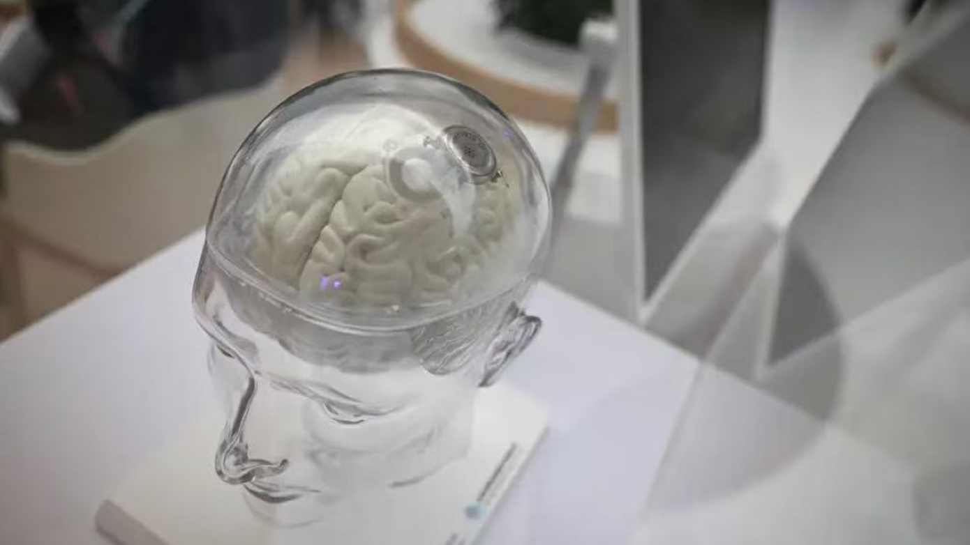  脑机接口商业化困局：信号采集与神经翻译的双重技术壁垒深度剖析 IT技术